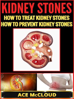 cover image of Kidney Stones